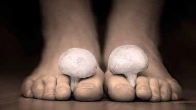 How to recognize the presence of fungus on your feet