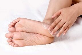 treatment of foot fungus with a cream