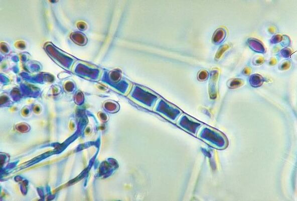 Trichophyton rubrum fungus under a microscope