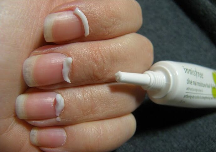 treatment of nail fungus with ointment